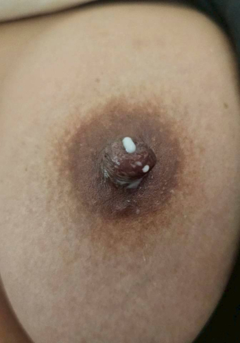 น้ำนมไหล